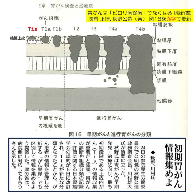 Image for the Tweet beginning: 参院厚労委にて質疑に立ちました。
私は、2014年に成立した、がん登録等の推進に関する法律（＝全国がん登録推進法）の発議者です。
全国がん登録推進法において、がんと診断した時点で医療機関の報告を求めることと定めました。 